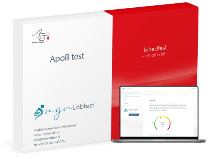 Dit is de ApoB test en een voorbeeld van hoe je uitslag er uit ziet Dit is de ApoB test en een voorbeeld van hoe je uitslag er uit ziet