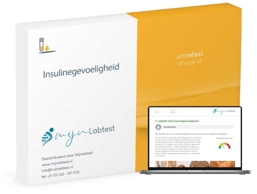 C-peptide test (insulinegevoeligheid) C-peptide test (insulinegevoeligheid)
