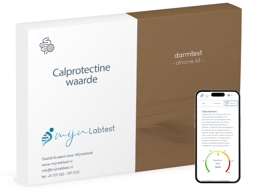 Calprotectine waarde test