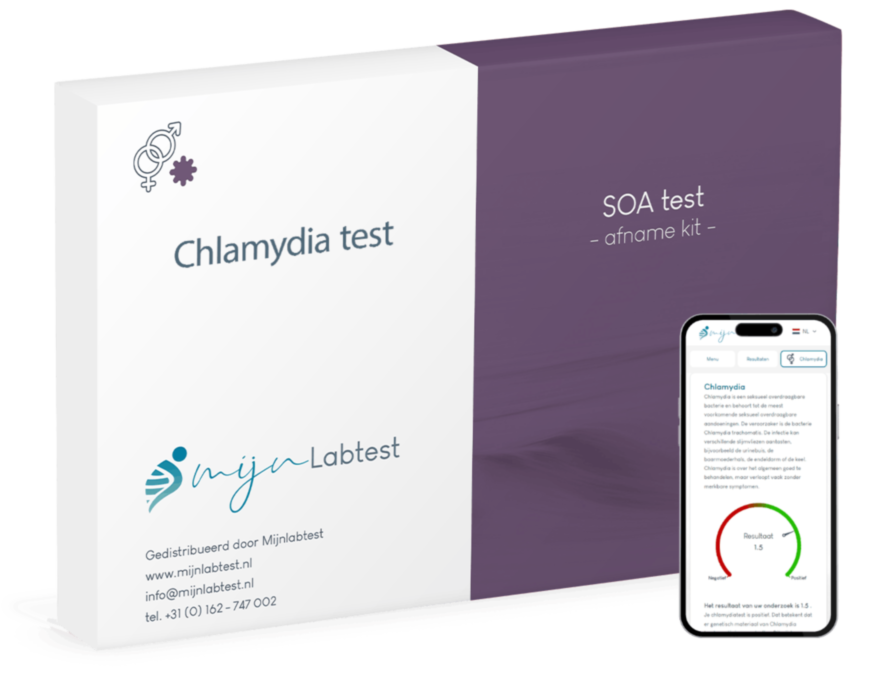 Chlamydia test Chlamydia test