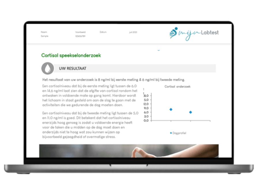 Cortisol onderzoek hormonen speekseltest vrouw 
