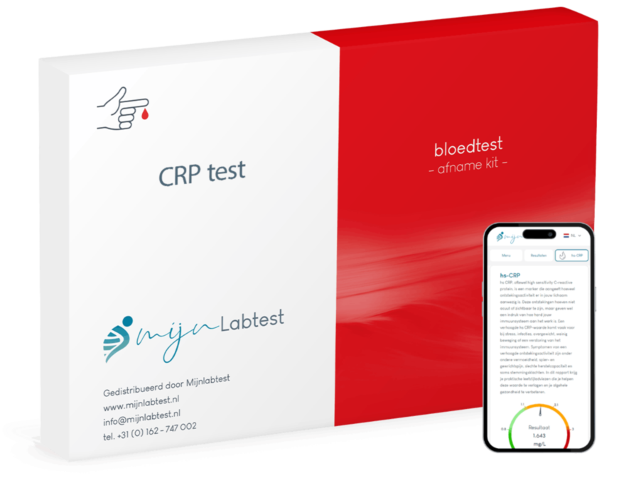 Dit is de CRP test. Je neemt zelf eenvoudig thuis je sample af en je krijgt een uitgebreid laboratorium rapport met leefstijl advies Dit is de CRP test. Je neemt zelf eenvoudig thuis je sample af en je krijgt een uitgebreid laboratorium rapport met leefstijl advies