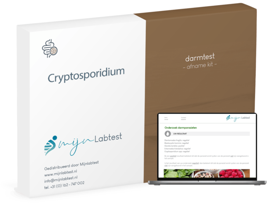 Cryptosporidium spp test