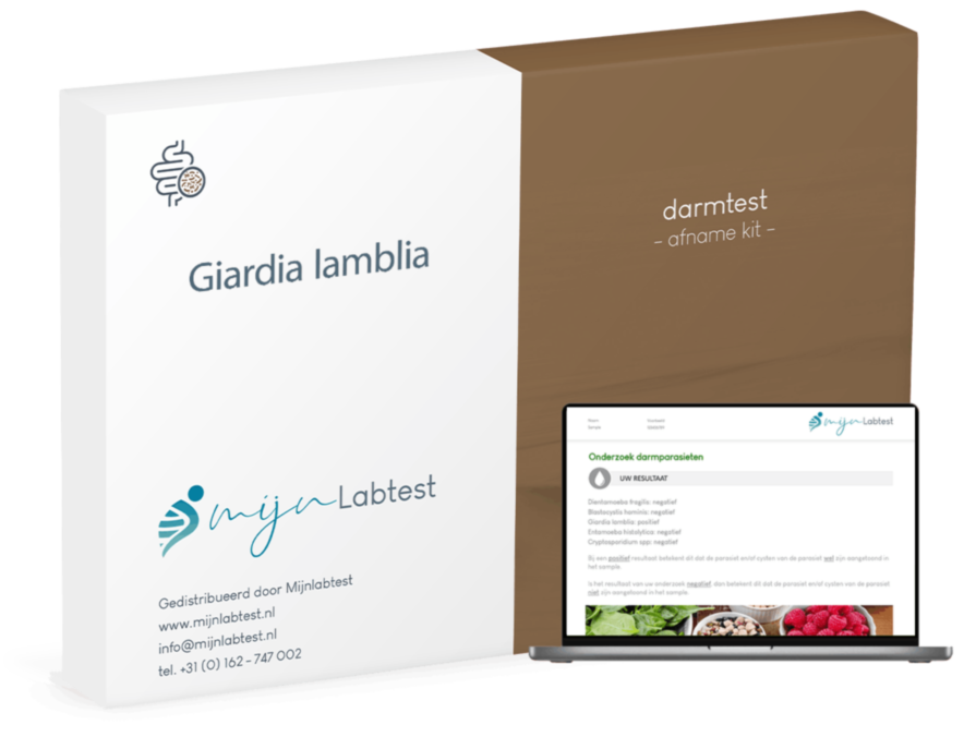 Giardia test Giardia test