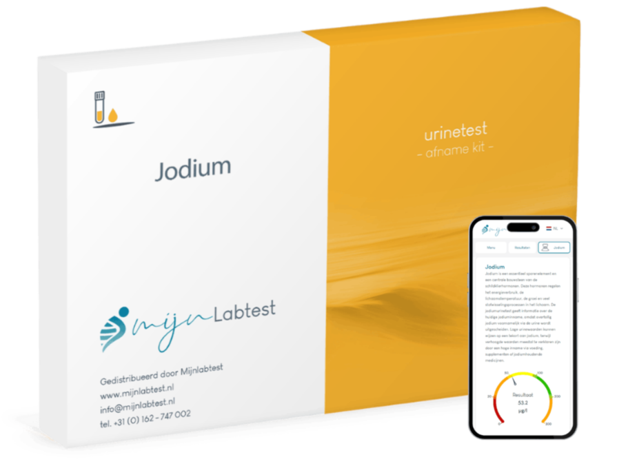 Jodium test Jodium test