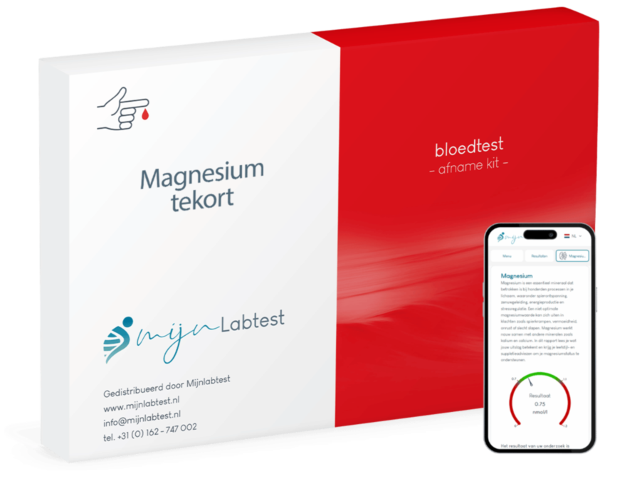 het magnesium tekort bloedonderzoek wordt afgenomen met een eenvoudige test kit die we naar je opsturen het magnesium tekort bloedonderzoek wordt afgenomen met een eenvoudige test kit die we naar je opsturen