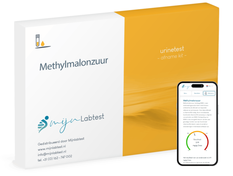 Test Methylmalonzuur Test Methylmalonzuur