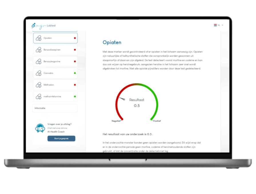 Opiaten resultaat drugs test