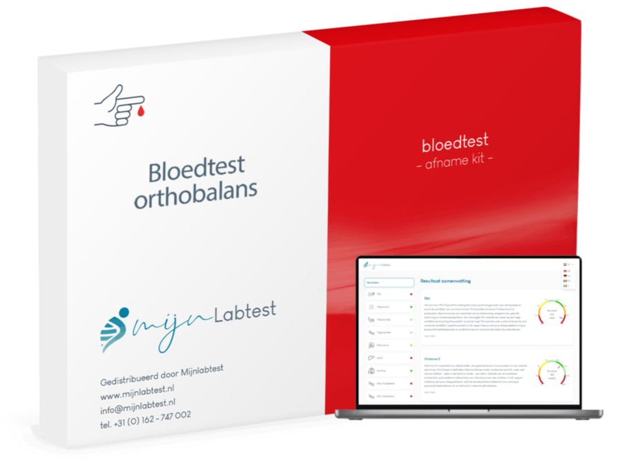 Bloedtest orthobalans test uitgebreid Bloedtest orthobalans test uitgebreid