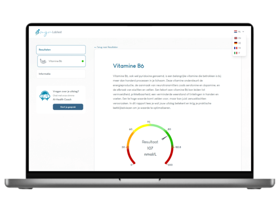 Zo ziet jouw vitamine B6 test resultaat eruit
