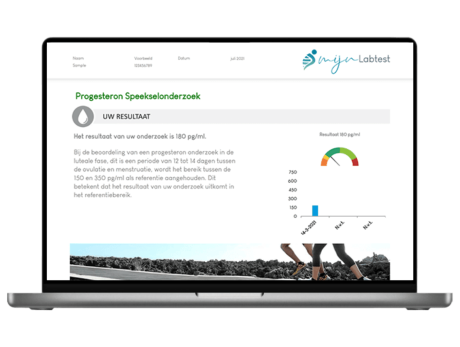 Progesteron speekselonderzoek vrouw 