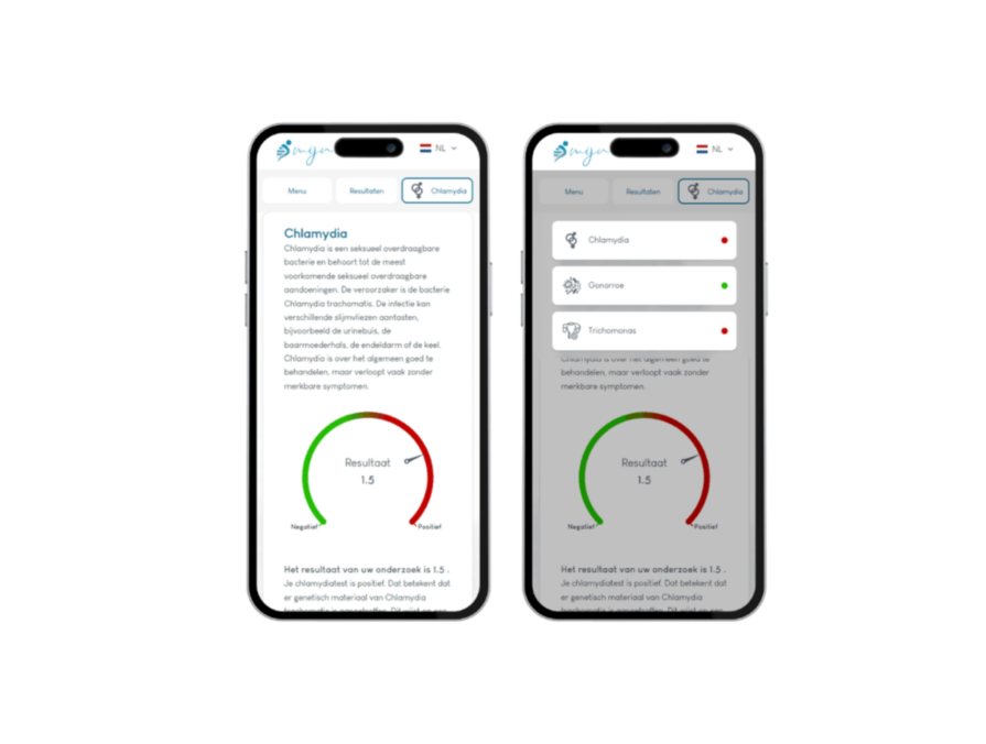 Telefoon resultaat Soa thuis test Telefoon resultaat Soa thuis test