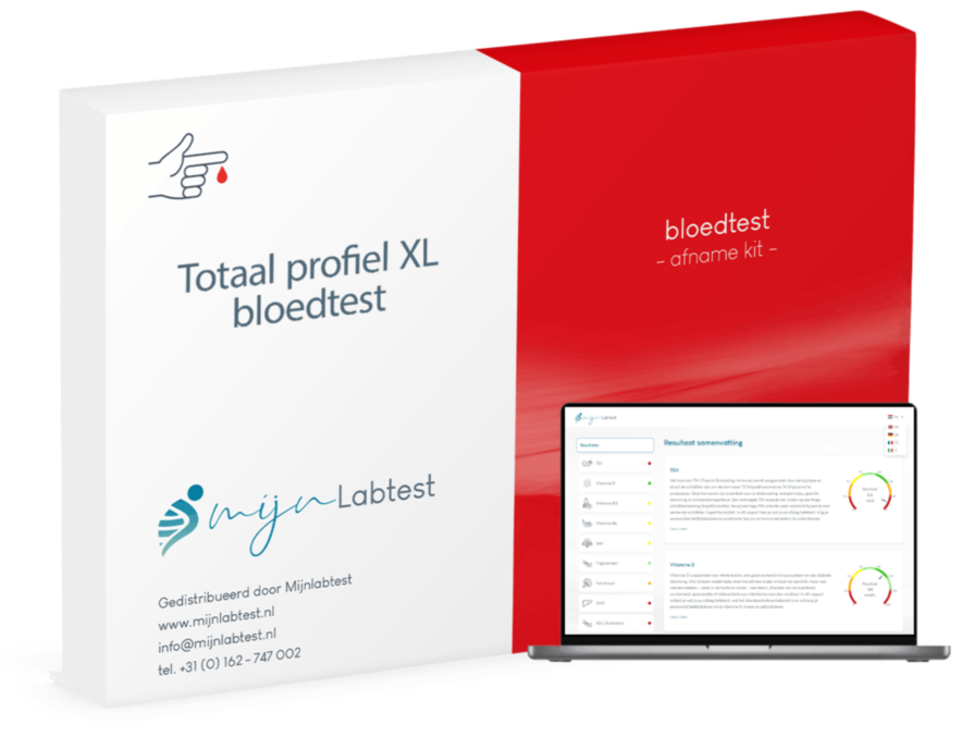 Dit is onze meest complete bloedtest om thuis af te nemen, het totaal profiel XL bloedtest. Eenvoudig via een vingerprik af te nemen. Je ontvangt een compleet rapport.