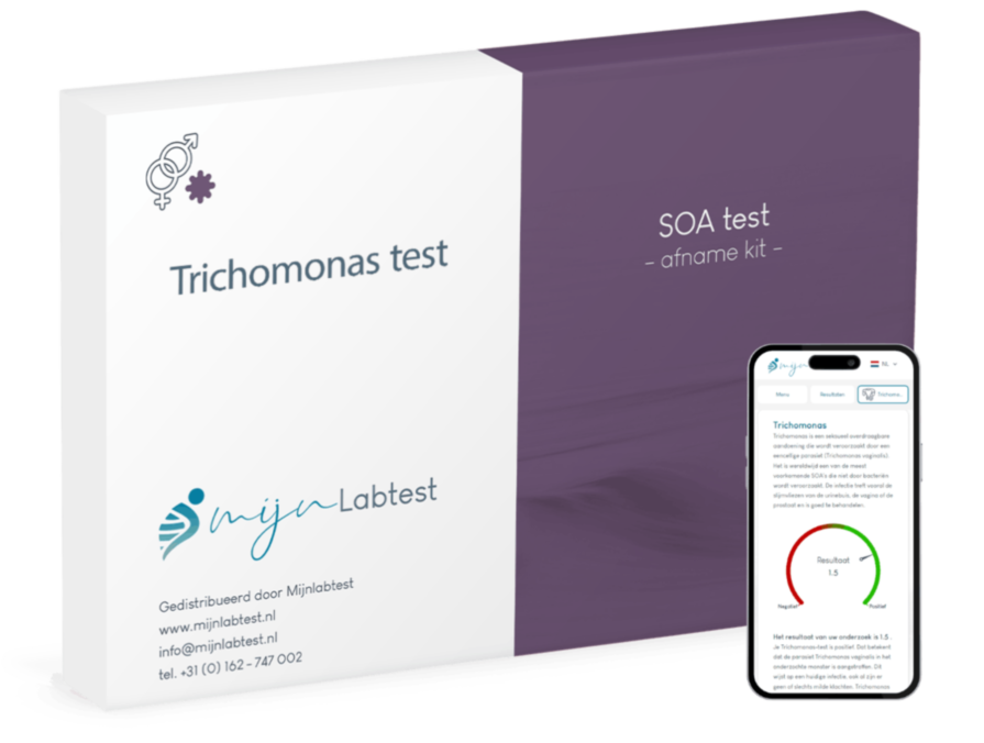 Trichomonas test Trichomonas test