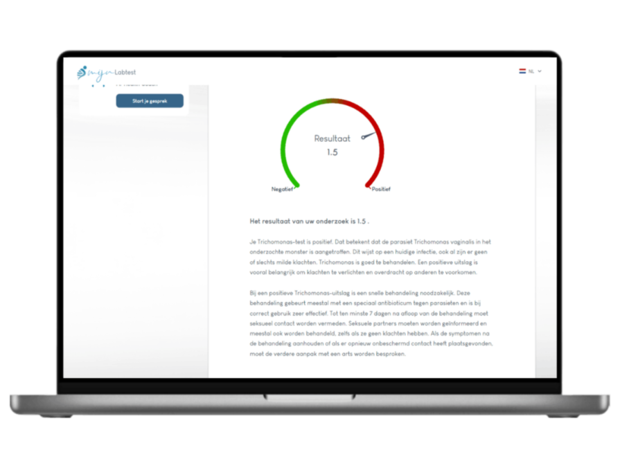 Leefstijl advies Trichomonas test Leefstijl advies Trichomonas test