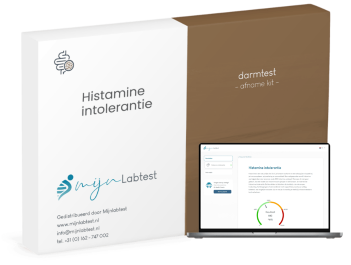 Dit is je histamine intolerantie test-kit