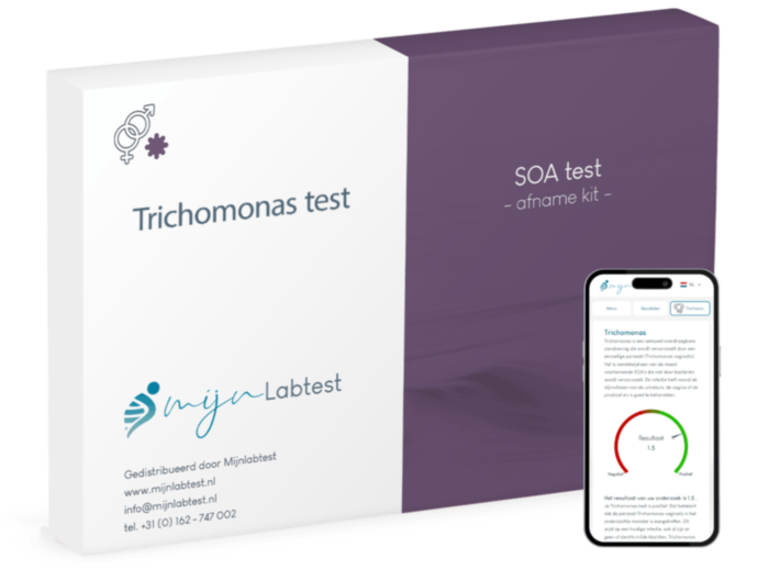 Trichomonas test