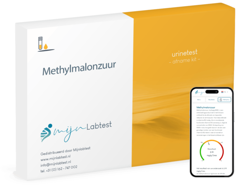 Test Methylmalonzuur