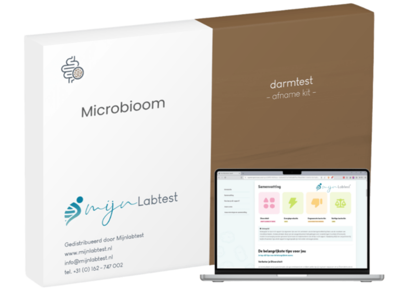 zo ziet jouw microbioom test er uit.