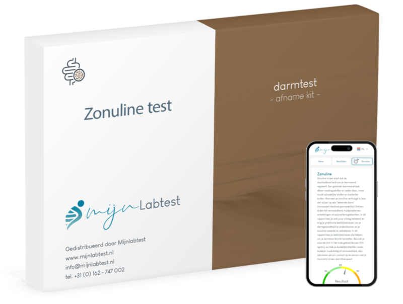 De zonuline test is er om te kijken of je een verhoogde darm doorlaatbaarheid hebt.