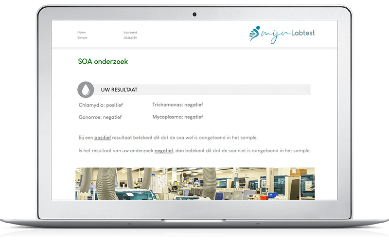 Veelvoorkomende soa's